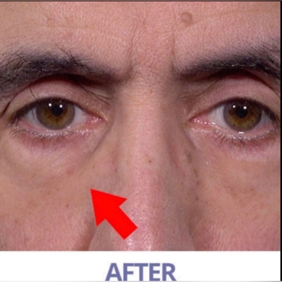 Fast Acting Eye Serum, Tint & Tighten (5) - Picture 7 of 15